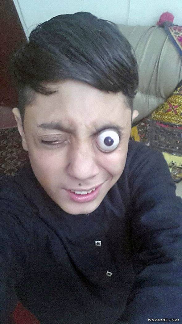 سرگرمی عجیب درآوردن چشم درآوردن چشم