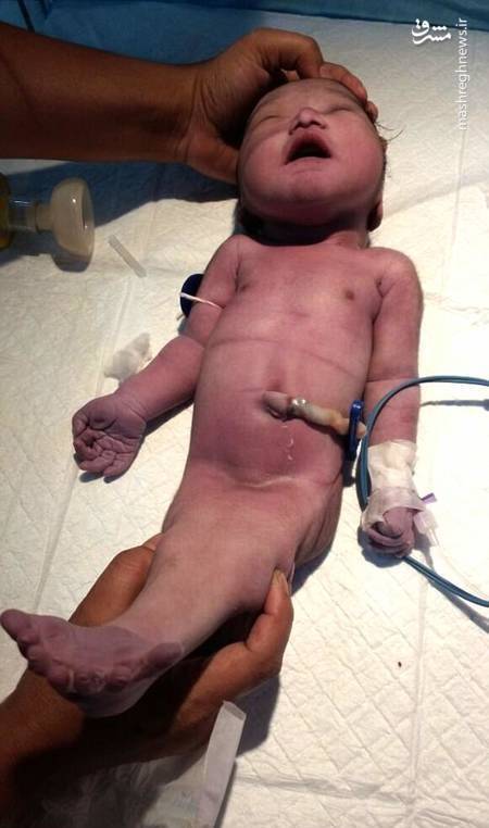 پری دریایی نوزاد عجیب