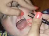ناخن بچه