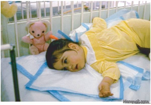  بیماری کودکان