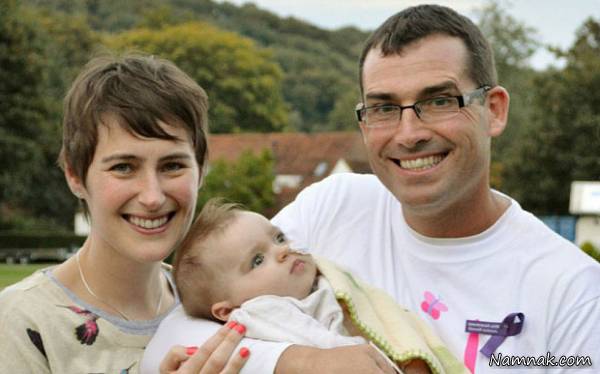 سندروم تای ساکس