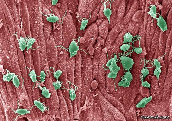 علت بیماری تریکومونیازیس 