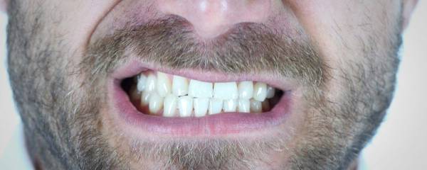 اکنتوسیتوز رقصاک