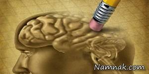 آلزایمر