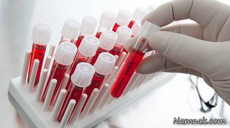 5 آزمایش ضروری 