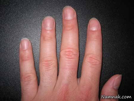 انگشتان دست 