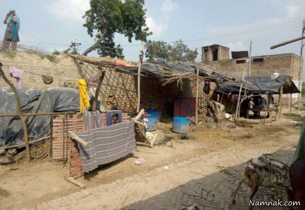 بیماری عجیب زن هندی