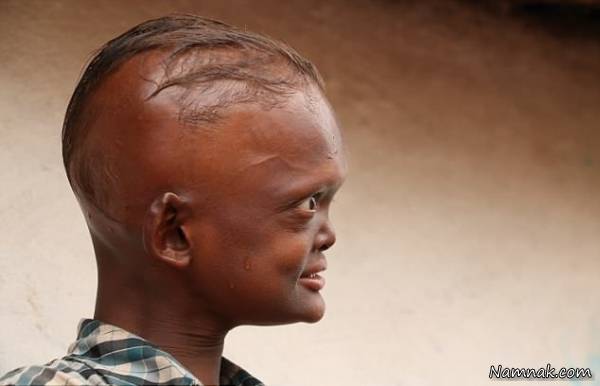 فرم سر خاص و عجیب فرم سر