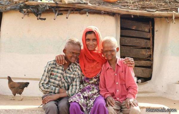 دو برادر با ژنتیک خاص دو بردار