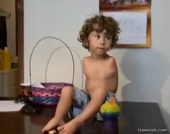 کودک بدون دست 