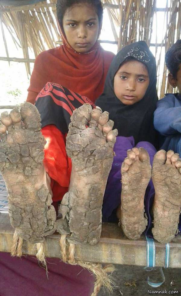 مبتلا به بیماری پوستی