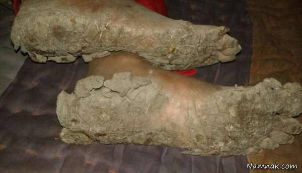 خواهران و برادران سنگی