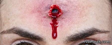 زنده ماندن با برخورد گلوله به سر برخورد گلوله