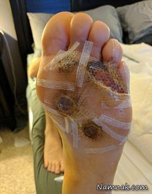 پابرهنه راه رفتن در اماکن عمومی پابرهنه راه رفتن