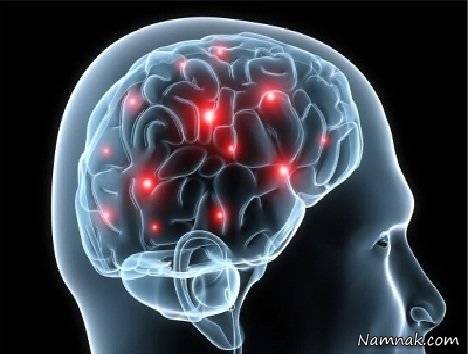 بیماران مغز و اعصاب