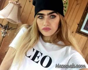 ابروهای پیوندی