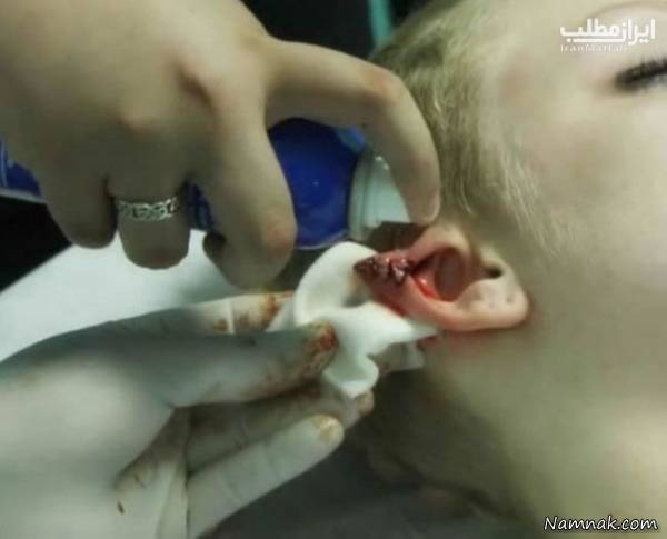 عمل های زیبایی عجیب