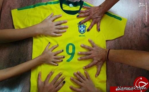 6 انگشتی شدن پا