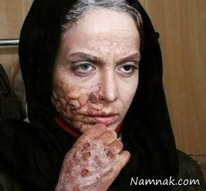 المیرا دهقانی