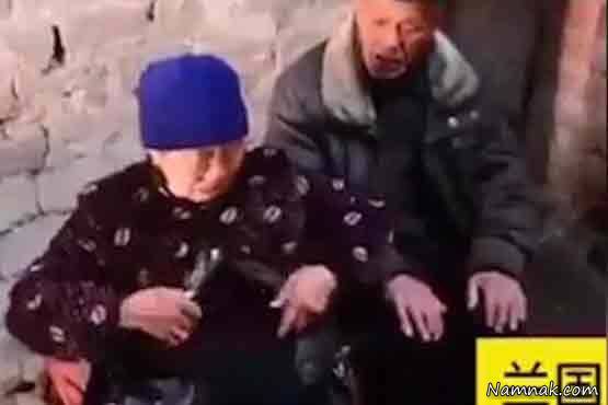 روده خارج از بدن