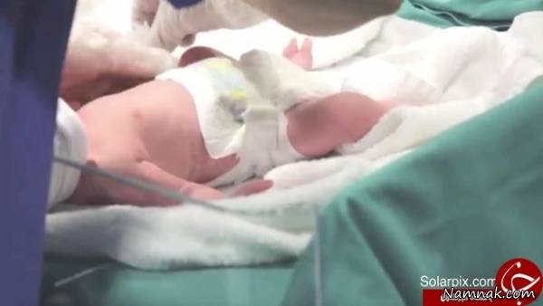 زایمان زن پیر دوقلو