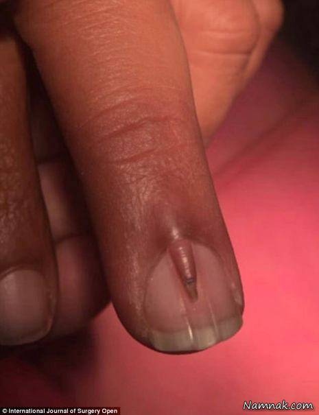 ناخن های عجیب و دو طبقه