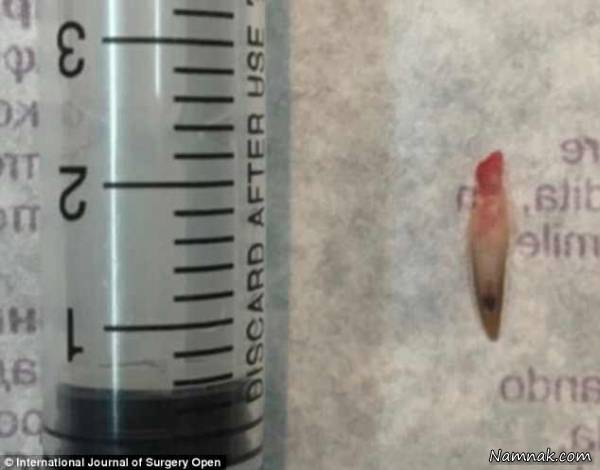 ناخن های عجیب و دو طبقه