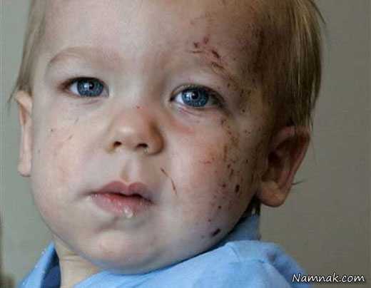 خوش شانس هایی که نمردند آدم های خوش شانس