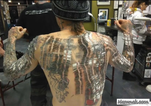 سوزن در بدن