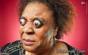 درازترین بینی