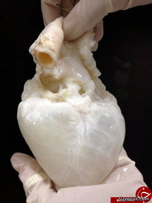 قلب بدون خون