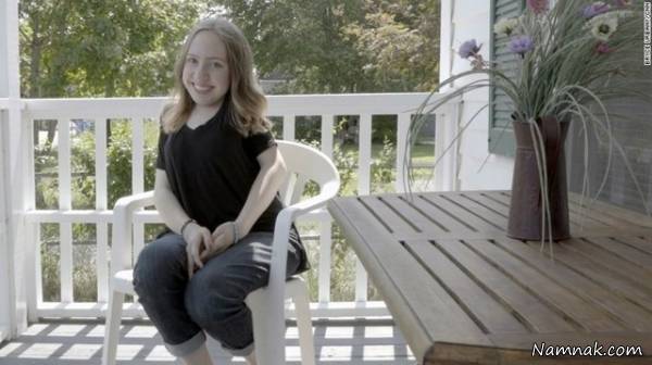 سنگ شدن بدن