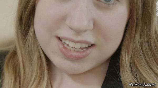 سنگ شدن بدن