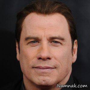 سلبریتی هایی که ریزش مو دارند + تصاویر ریزش مو