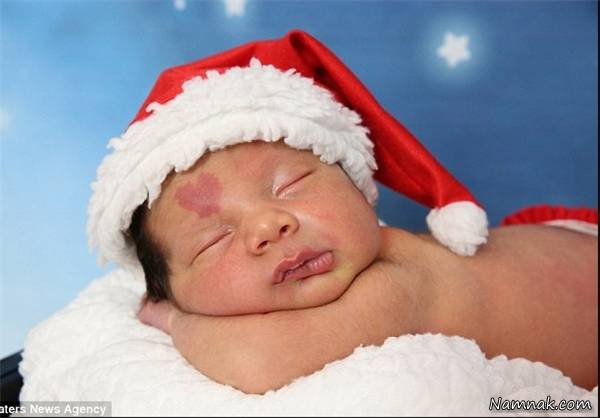 نوزادی که روی پیشانیش علامت قلب دارد + عکس پیشانی نوزاد