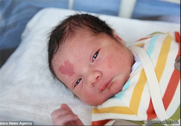 نوزادی که روی پیشانیش علامت قلب دارد + عکس پیشانی نوزاد
