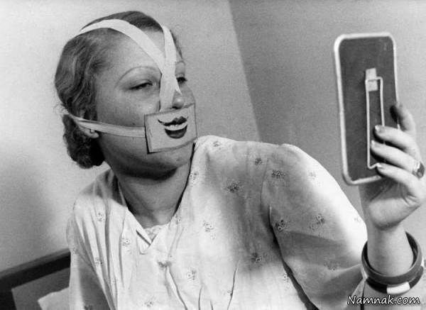 افسردگی خندان