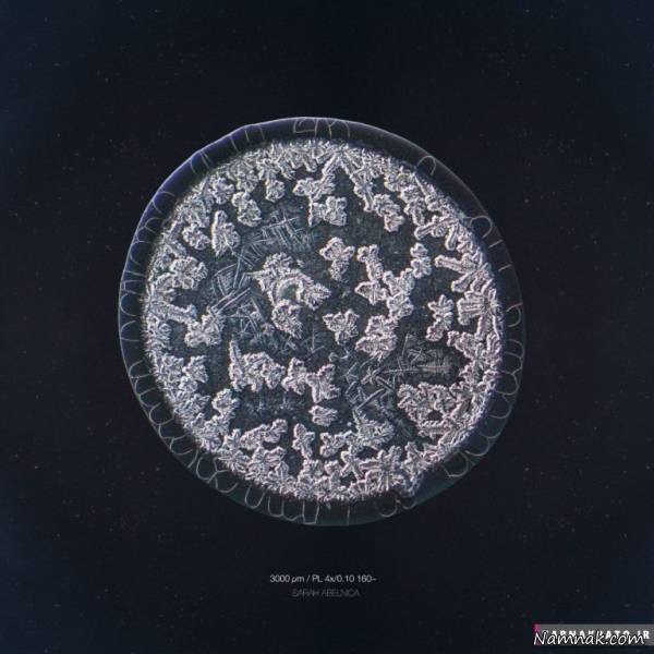 شگفتی قطرات اشک در زیر میکروسکوپ قطرات اشک