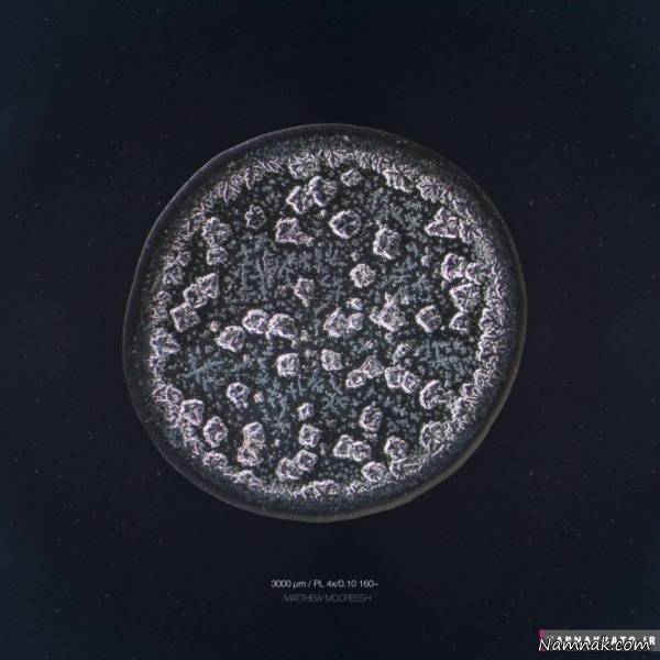 شگفتی قطرات اشک در زیر میکروسکوپ قطرات اشک