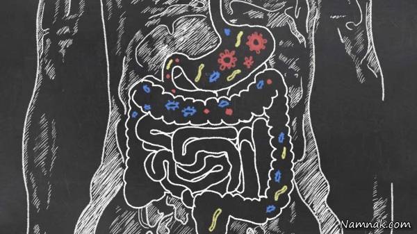 بیماری پارکیسنون