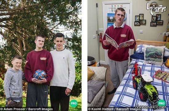 بیماری مادرزادی عجیب این نوجوان + عکس بیماری مادرزادی