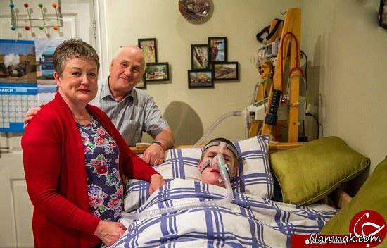 بیماری مادرزادی عجیب این نوجوان + عکس بیماری مادرزادی