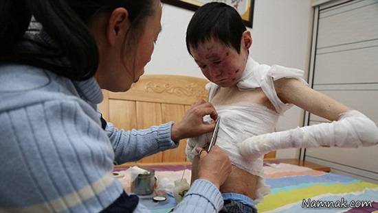 پوست ظریف پسر 19 ساله چینی پوست ظریف پسر 19 ساله