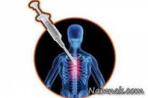 بی حسی اپیدورال