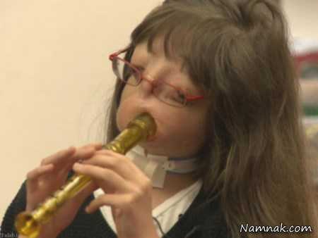 بیماری عجیب دختر بدون چهره