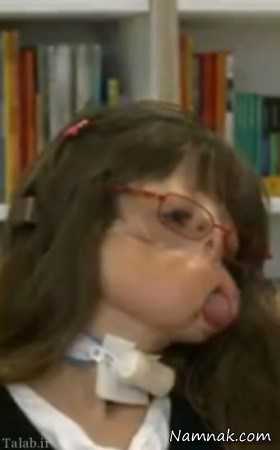 بیماری عجیب دختر بدون چهره