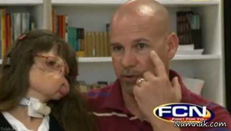 بیماری عجیب دختر بدون چهره