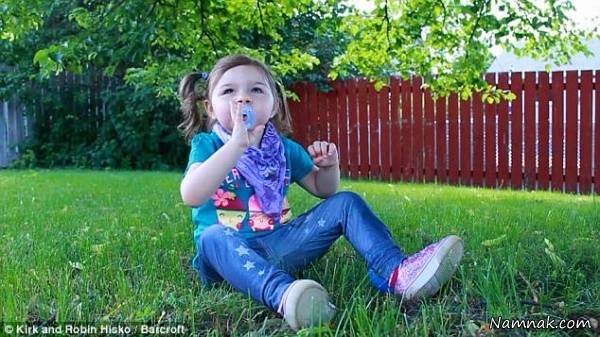 بیماری سندرم آنجلمن در دختر 3 ساله کانادایی سندرم آنجلمن