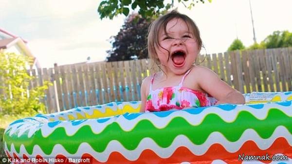 علائم بیماری سندرم آنجلمن در دختر 3 ساله کانادایی سندرم آنجلمن