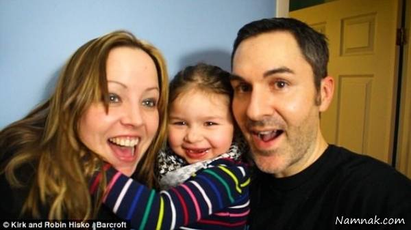 علائم بیماری سندرم آنجلمن در دختر 3 ساله کانادایی سندرم آنجلمن